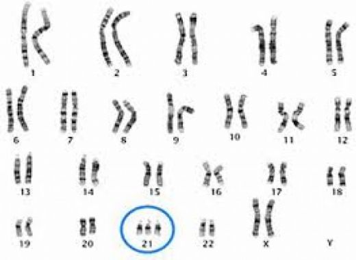 21 Kromozom