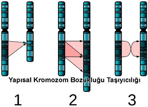 7 Kromozom Bozukluğu