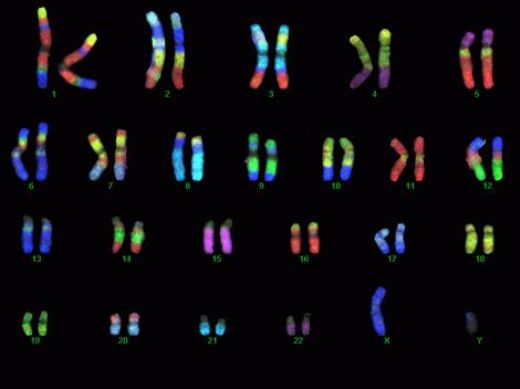 Gen Kromozom Teorisi
