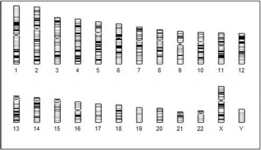 Kromozom Analizi